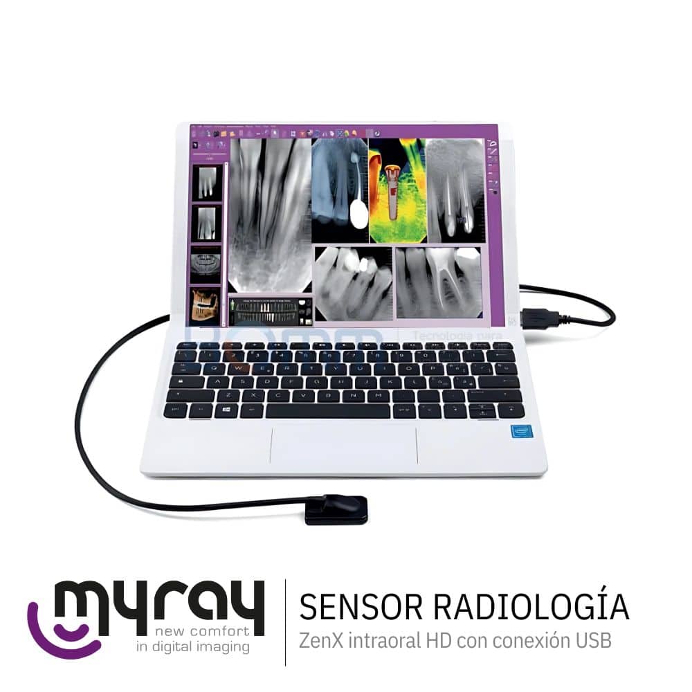 ZenX | Sensor Radiología Digital