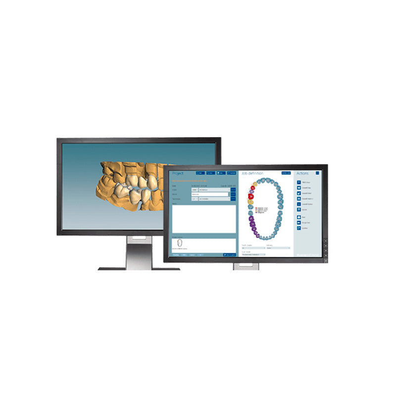 Ceramill Mind | Software para puentes y coronas