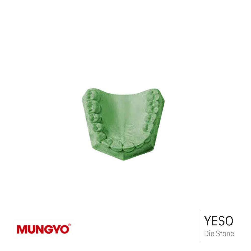 Die Stone | Yeso para Prótesis Fija