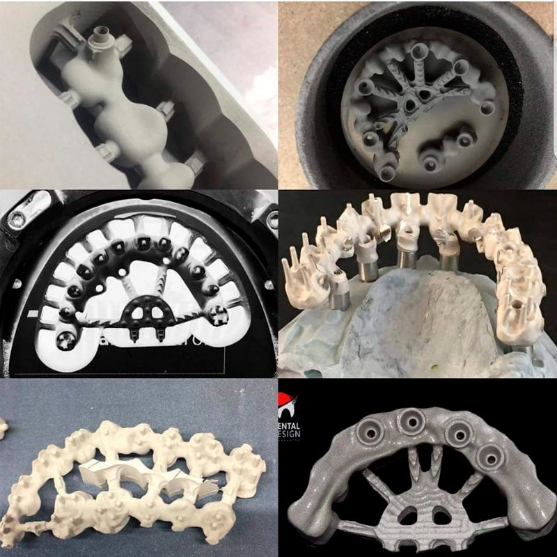 Ceramill Incadcam | Software para implantes