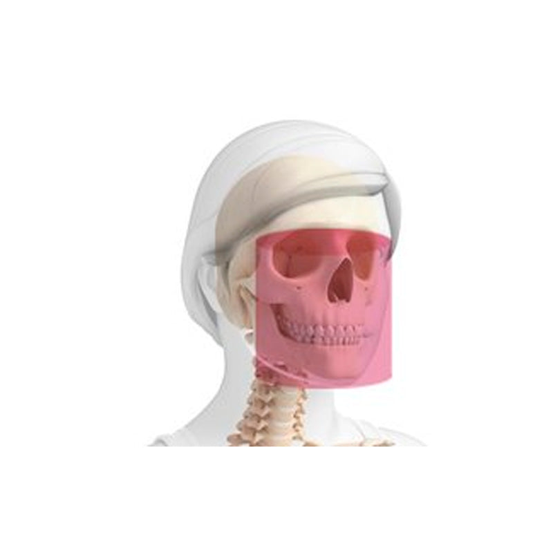 Actualización Hyperion X9 Pro - FOV 13x16