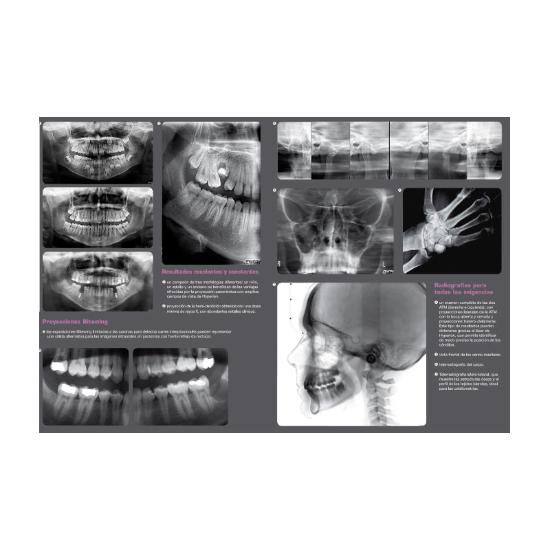 Actualización X9 - CEPH