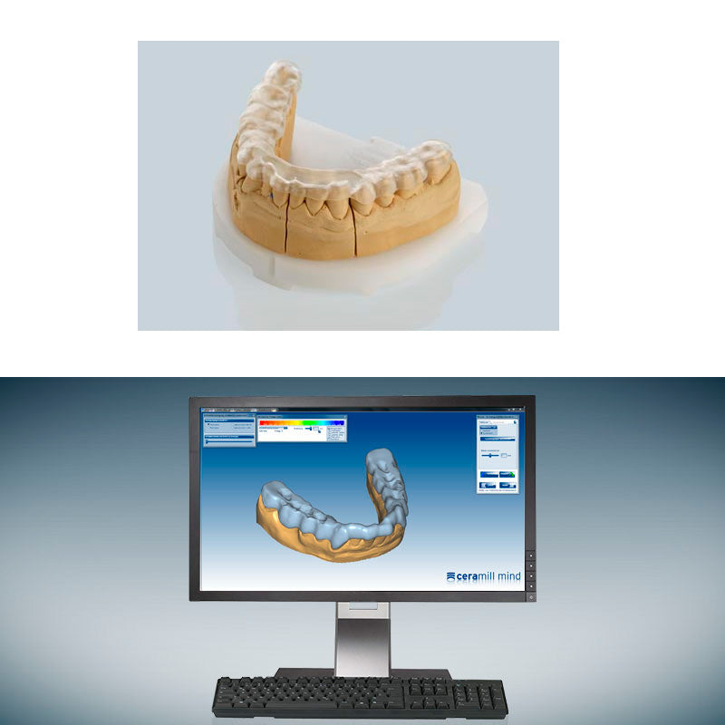 Splint Software Ceramill M-Splint | Software para férulas – Comercial Bomm Ltda