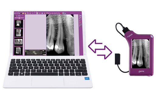 Xpod | Sistema de Radiología Intraoral Inalámbrico
